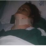 Mujer agredida por su esposo en Hato del Yaque pierde la memoria